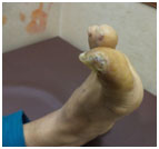 Surgical-Treatment-2