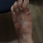 Before Treatment 1 Before Treatment 1