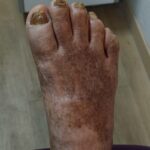 Before Treatment 2 Before Treatment 2